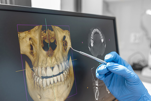 Wesley Chapel Dentist Using One of His New Digital Dentistry Machines
