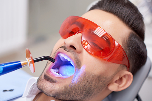 Ongoing Laser Dentistry Session at a Dental Clinic in Wesley Chapel FL