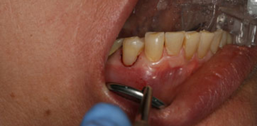 Better Teeth of Wesley Chapel Man After Visiting Dental Clinic with Modern Technology and Techniques