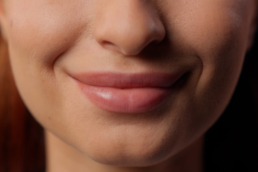 Wesley Chapel Lady Smiling After Getting Dermal Fillers